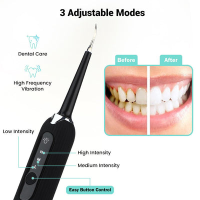 High Frequency Electric Ultrasonic Dental Tartar Plaque Calculus Tooth Remover Set Kits Cleaner with LED Screen Light Green